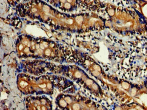 Immunohistochemistry (Formalin/PFA-fixed paraffin-embedded sections) - Anti-LDH-C antibody (AB222910)