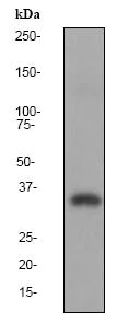 Western blot - Anti-LDH-C antibody [EP1567Y] - BSA and Azide free (AB247424)