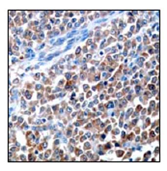 Immunohistochemistry (Formalin/PFA-fixed paraffin-embedded sections) - Anti-LDH-C antibody [EP1746Y] (AB52747), expandable thumbnail