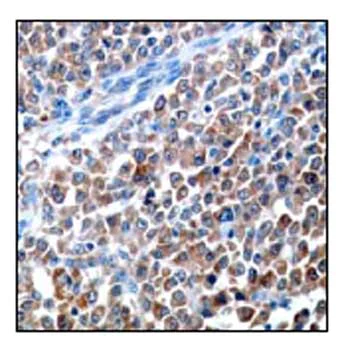 Immunohistochemistry (Formalin/PFA-fixed paraffin-embedded sections) - Anti-LDH-C antibody [EP1746Y] (AB52747)