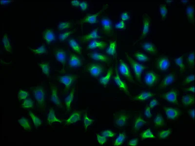 Immunocytochemistry/ Immunofluorescence - Anti-LDL Receptor antibody [2B10] (AB314008)