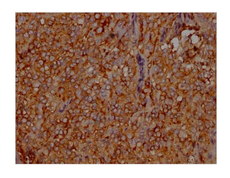 Immunohistochemistry (Formalin/PFA-fixed paraffin-embedded sections) - Anti-LDL Receptor antibody [2B10] (AB314008)