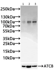 Western blot - Anti-LDL Receptor antibody [2B10] (AB314008)