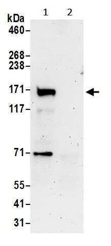 Immunoprecipitation - Anti-LDL Receptor antibody (AB240748)