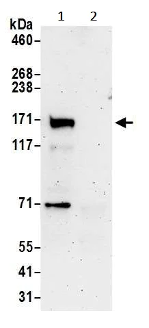 Immunoprecipitation - Anti-LDL Receptor antibody (AB240748)
