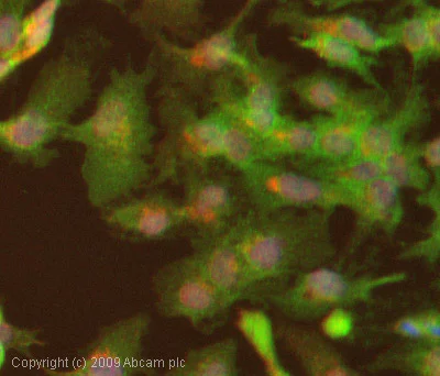 Immunocytochemistry/ Immunofluorescence - Anti-LDL Receptor antibody (AB30532)