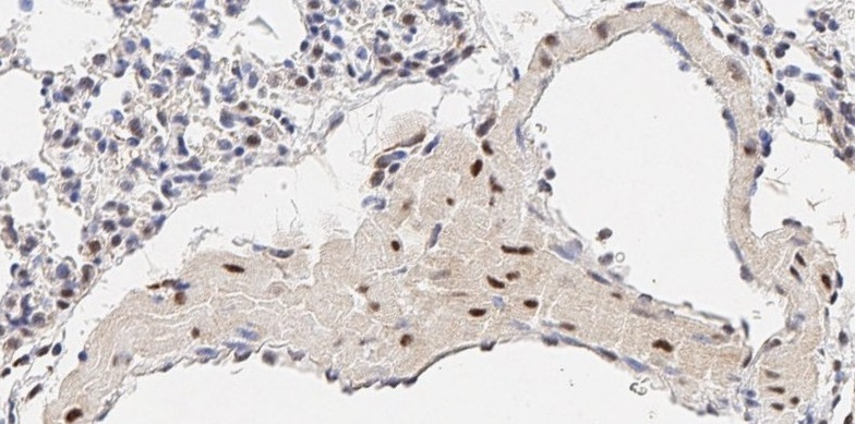 Immunohistochemistry (Formalin/PFA-fixed paraffin-embedded sections) - Anti-LDL Receptor antibody (AB30532)