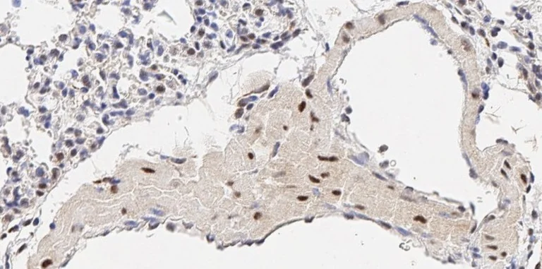 Immunohistochemistry (Formalin/PFA-fixed paraffin-embedded sections) - Anti-LDL Receptor antibody (AB30532)