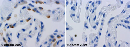 Immunohistochemistry (Formalin/PFA-fixed paraffin-embedded sections) - Anti-LDL Receptor antibody (AB30532)