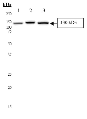 Western blot - Anti-LDL Receptor antibody (AB30532)