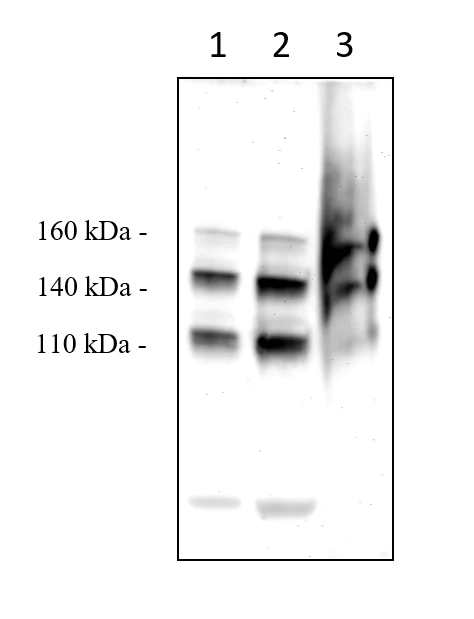 Western blot - Anti-LDL Receptor antibody (AB30532)
