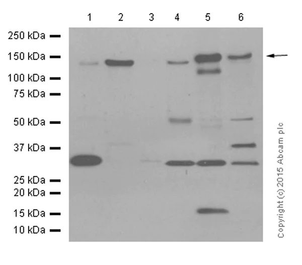 Western blot - Anti-LDL Receptor antibody [EP1553Y] (AB52818)