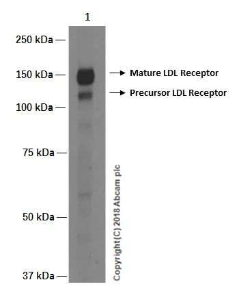 Western blot - Anti-LDL Receptor antibody [EP1553Y] (AB52818)
