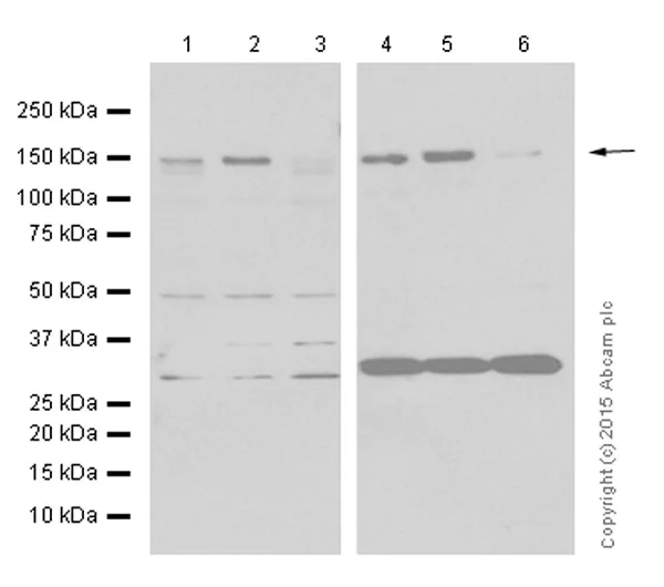 Western blot - Anti-LDL Receptor antibody [EP1553Y] (AB52818)