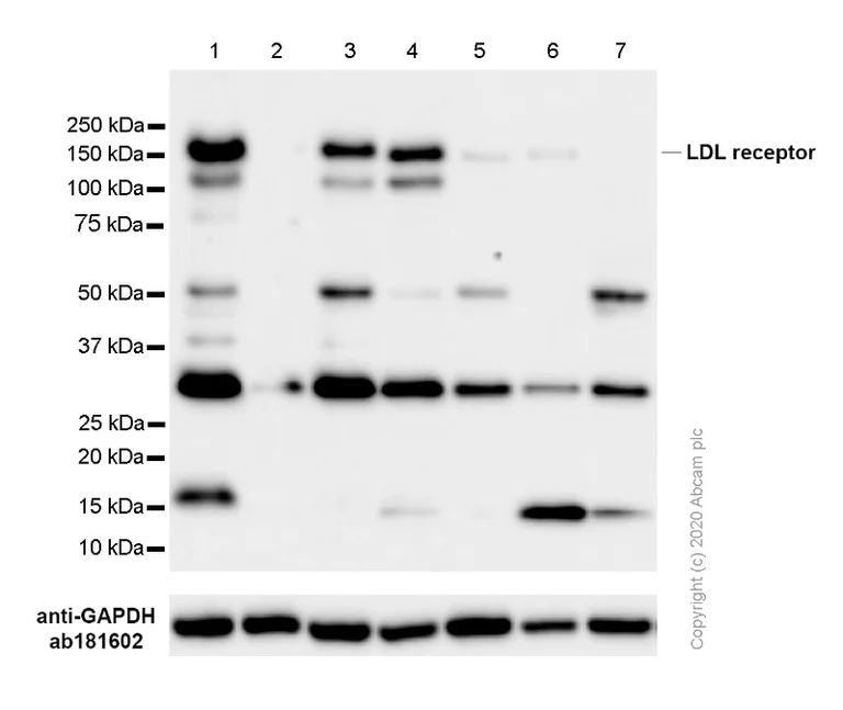 Western blot - Anti-LDL Receptor antibody [EP1553Y] (AB52818)