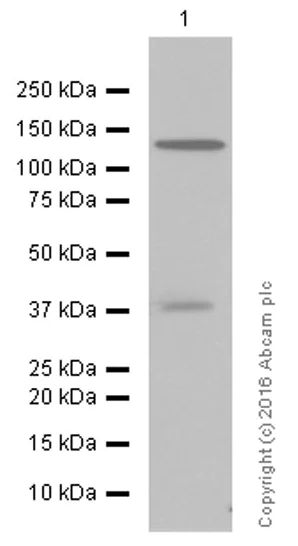 Western blot - Anti-LDL Receptor antibody [EP1553Y] (AB52818)