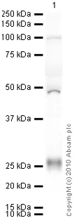 Western blot - Anti-LDL Receptor antibody [EP1553Y] (AB52818)
