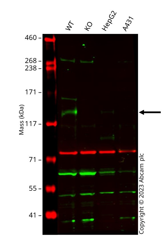 Western blot - Anti-LDL Receptor antibody [EP1553Y] (AB52818)
