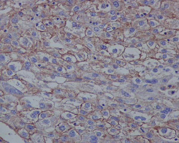 Immunohistochemistry (Formalin/PFA-fixed paraffin-embedded sections) - Anti-LDL Receptor antibody [EP1553Y] - BSA and Azide free (AB271846)