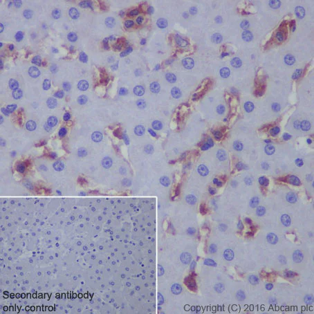 Immunohistochemistry (Formalin/PFA-fixed paraffin-embedded sections) - Anti-LDL Receptor antibody [EP1553Y] - Low endotoxin, Azide free (AB215980)