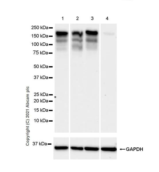 Western blot - Anti-LDL Receptor antibody [EPR24874-56] (AB271189)