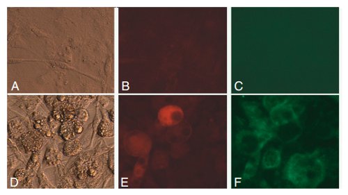 Functional Studies - LDL Uptake Assay Kit (Cell-Based) (AB133127)