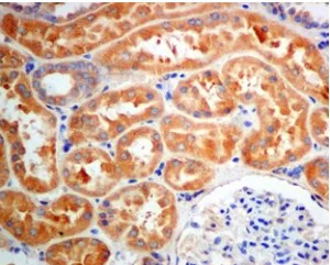 Immunohistochemistry (Formalin/PFA-fixed paraffin-embedded sections) - Anti-LDLC antibody [EPR10896] - BSA and Azide free (AB249429)