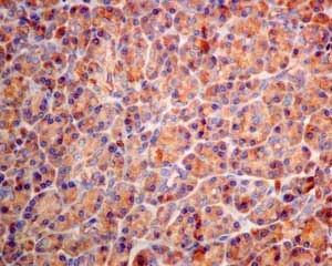 Immunohistochemistry (Formalin/PFA-fixed paraffin-embedded sections) - Anti-LDLC antibody [EPR10896] - BSA and Azide free (AB249429)