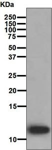 Western blot - Anti-LEC antibody [EPR4451(2)] (AB126717)