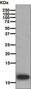 Western blot - Anti-LEC antibody [EPR4451(2)] (AB126717)