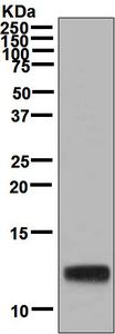 Western blot - Anti-LEC antibody [EPR4452(2)] (AB134917), expandable thumbnail