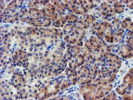 Immunohistochemistry (Formalin/PFA-fixed paraffin-embedded sections) - Anti-LECT2 antibody [OTI2A11] (AB119429)