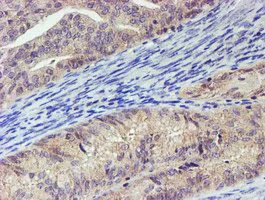 Immunohistochemistry (Formalin/PFA-fixed paraffin-embedded sections) - Anti-LECT2 antibody [OTI2A11] (AB119429)