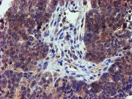Immunohistochemistry (Formalin/PFA-fixed paraffin-embedded sections) - Anti-LECT2 antibody [OTI2A11] (AB119429)
