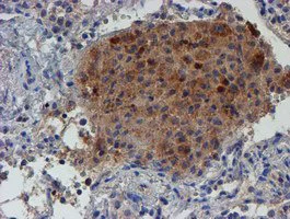 Immunohistochemistry (Formalin/PFA-fixed paraffin-embedded sections) - Anti-LECT2 antibody [OTI2A11] (AB119429)