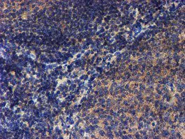 Immunohistochemistry (Formalin/PFA-fixed paraffin-embedded sections) - Anti-LECT2 antibody [OTI2A11] (AB119429)