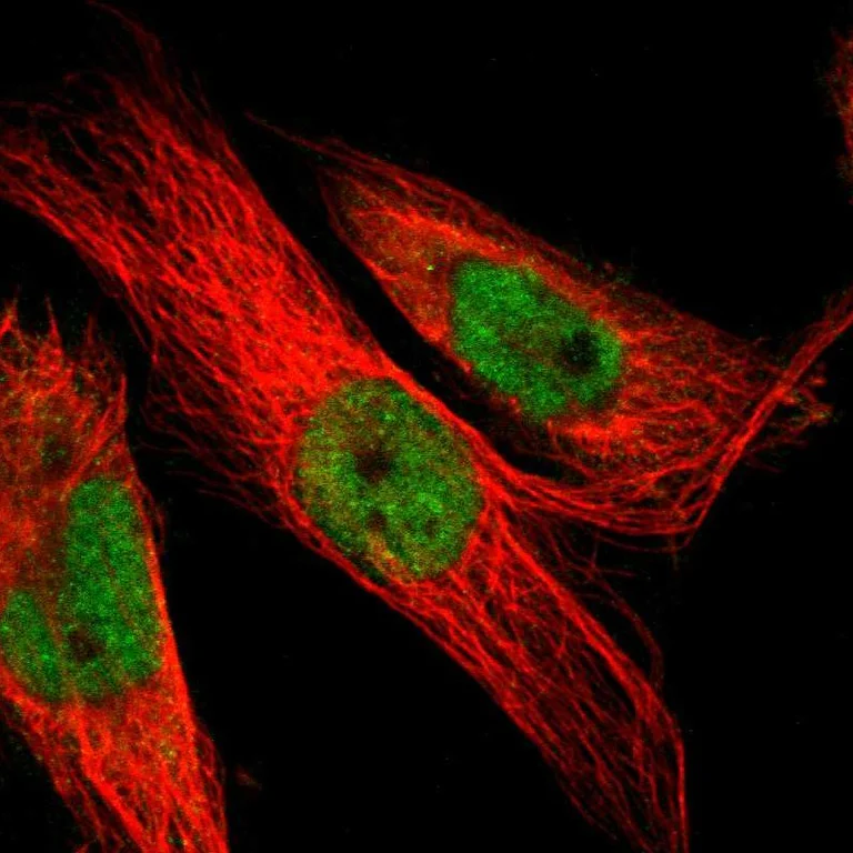 Immunocytochemistry/ Immunofluorescence - Anti-LEF1 Antibody (AB327174)