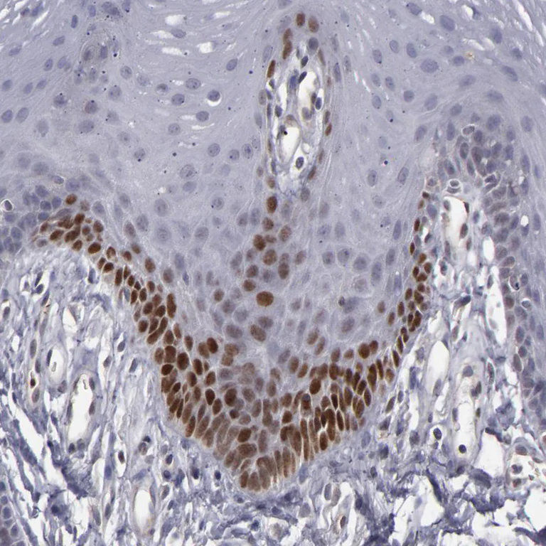Immunohistochemistry (Formalin/PFA-fixed paraffin-embedded sections) - Anti-LEF1 Antibody (AB327174)