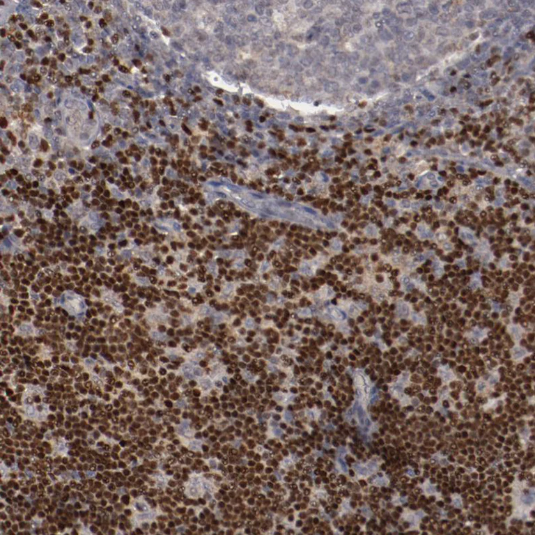 Immunohistochemistry (Formalin/PFA-fixed paraffin-embedded sections) - Anti-LEF1 Antibody (AB327174)