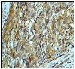 Immunohistochemistry (Formalin/PFA-fixed paraffin-embedded sections) - Anti-LEF1 antibody [EP2030Y] (AB53293)
