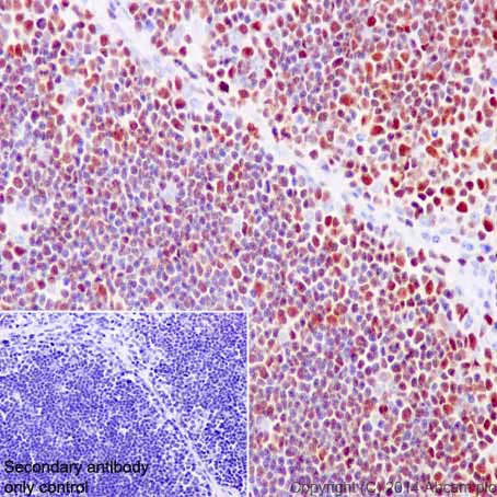 Immunohistochemistry (Formalin/PFA-fixed paraffin-embedded sections) - Anti-LEF1 antibody [EPR2029Y] (AB137872)
