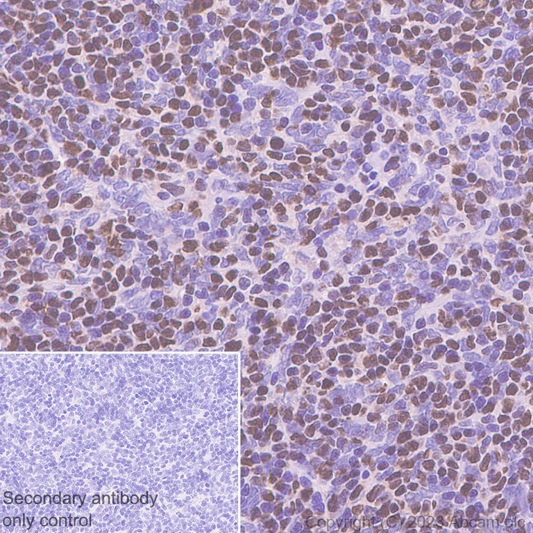 Immunohistochemistry (Formalin/PFA-fixed paraffin-embedded sections) - Anti-LEF1 antibody [EPR2029Y] (AB137872)