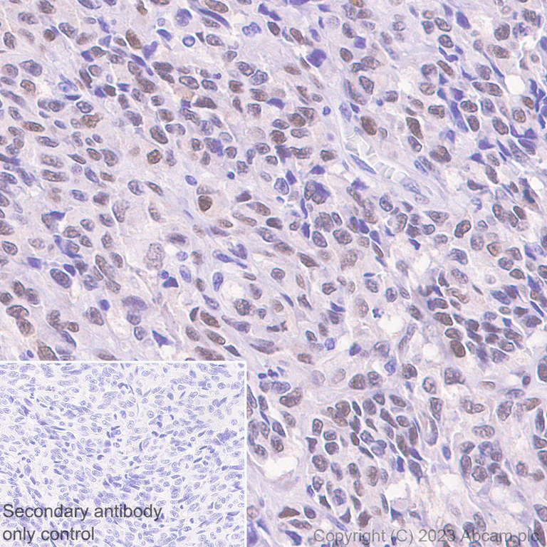 Immunohistochemistry (Formalin/PFA-fixed paraffin-embedded sections) - Anti-LEF1 antibody [EPR2029Y] (AB137872)
