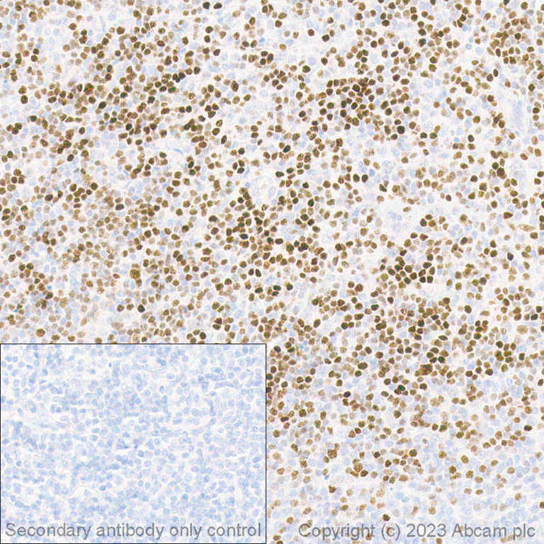 Immunohistochemistry (Formalin/PFA-fixed paraffin-embedded sections) - Anti-LEF1 antibody [EPR2029Y] (AB137872)
