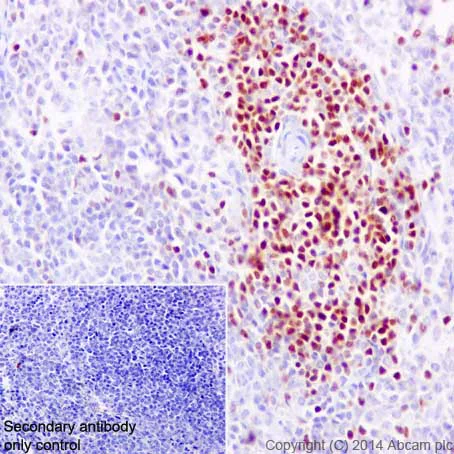 Immunohistochemistry (Formalin/PFA-fixed paraffin-embedded sections) - Anti-LEF1 antibody [EPR2029Y] (AB137872)