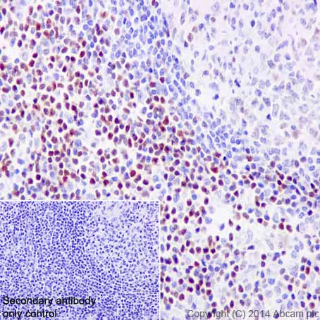 Immunohistochemistry (Formalin/PFA-fixed paraffin-embedded sections) - Anti-LEF1 antibody [EPR2029Y] (AB137872)