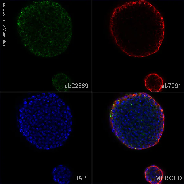 Immunocytochemistry/ Immunofluorescence - Anti-Lefty antibody (AB22569)