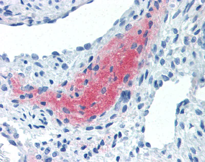 Immunohistochemistry (Formalin/PFA-fixed paraffin-embedded sections) - Anti-LEFTY2 antibody [7C5G1H6H10] (AB115224)