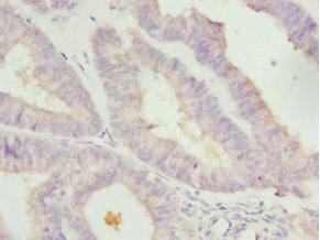 Immunohistochemistry (Formalin/PFA-fixed paraffin-embedded sections) - Anti-LEFTY2 antibody (AB229668), expandable thumbnail