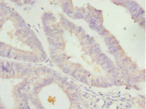 Immunohistochemistry (Formalin/PFA-fixed paraffin-embedded sections) - Anti-LEFTY2 antibody (AB229668)
